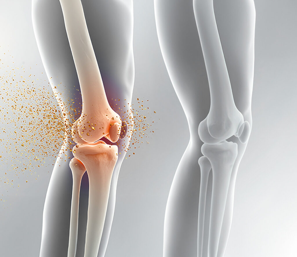 ortho-lappan-hyalurontherapie
